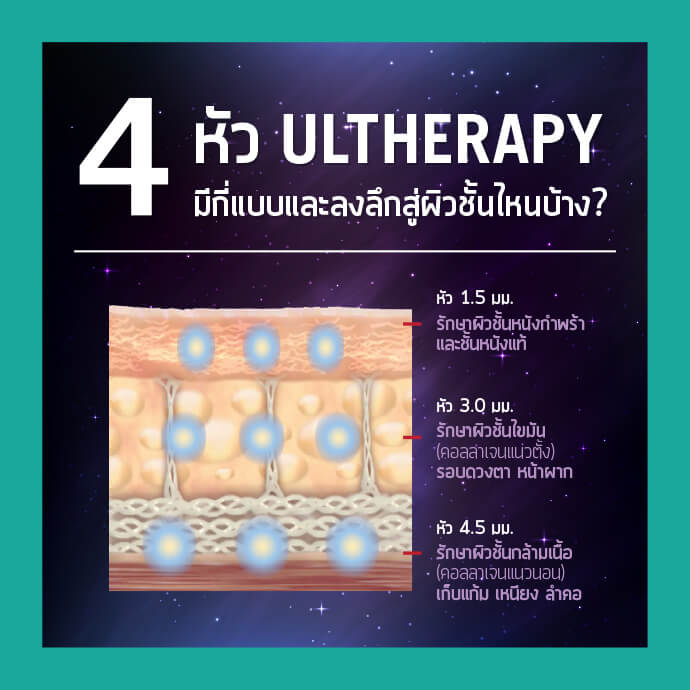 Ulthera Ultherapy Ulthera ราคา Ulthera คือ Ulthera รีวิว ยกกระชับหน้า เครื่องยกกระชับหน้า pongsakclinic