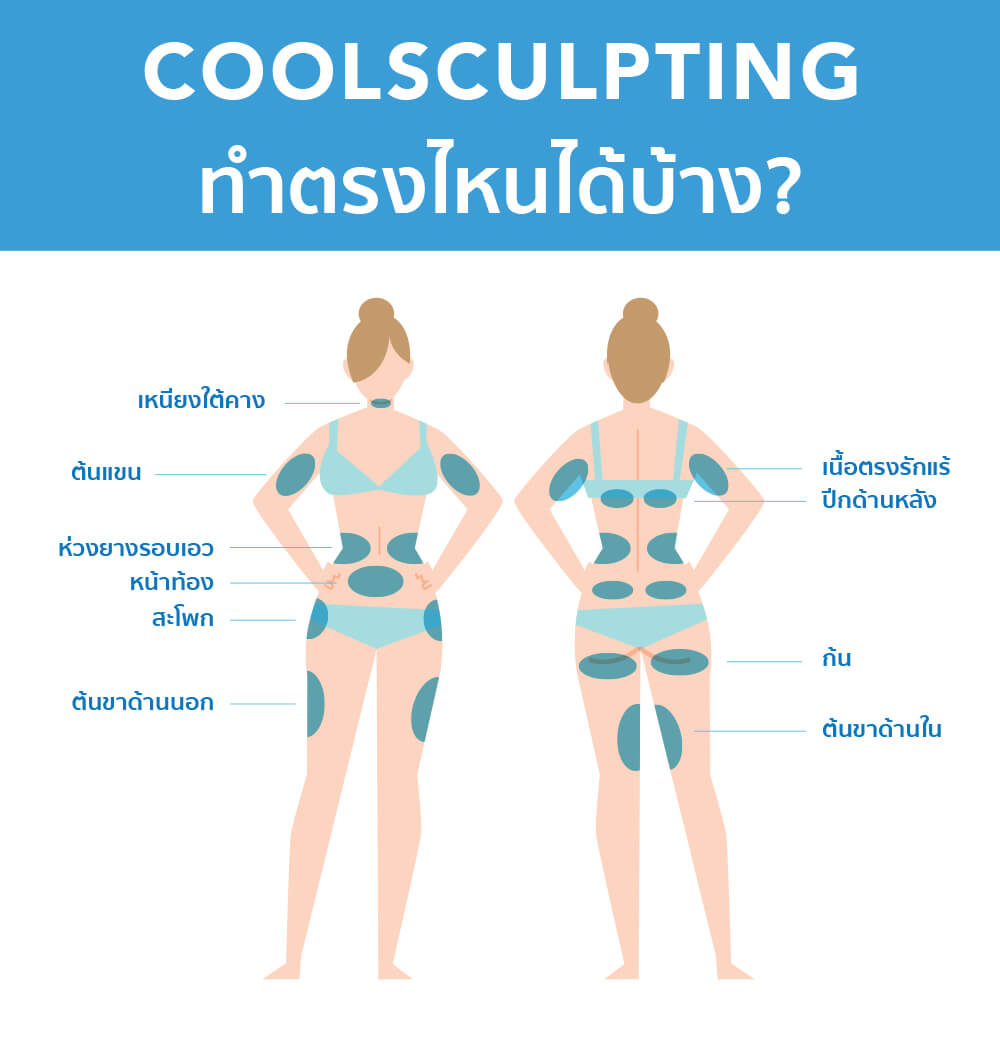 Coolsculpting สลายไขมันด้วยความเย็น ราคา ที่ไหนดี pantip Pongsak clinic