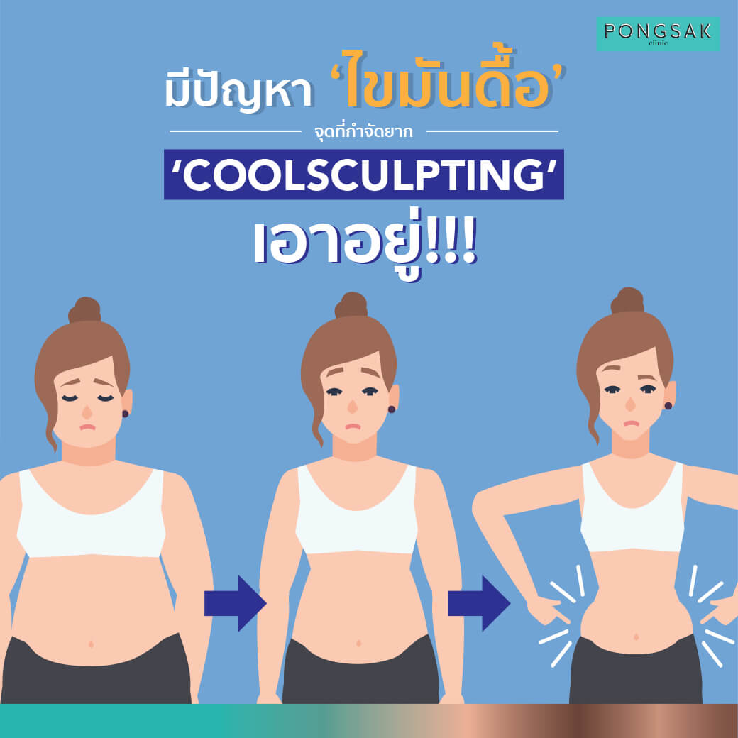 Coolsculpting 2022, Coolsculpting ราคา, Coolsculpting คือ, กระบวนการสลายไขมัน, Coolsculpting รีวิว, Coolsculpting ที่ไหนดี, Coolsculpting โปรโมชั่น, Coolsculpting ทำกี่ครั้ง, สลายไขมันด้วยความเย็น, สลายไขมันด้วยความเย็น pantip, สลายไขมันด้วยความเย็น ราคา, Coolsculpting ต้นขา, พงศ์ศักดิ์คลินิก, pongsakclinic, pongsakclinicpetite